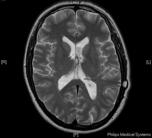 brain.jpg
